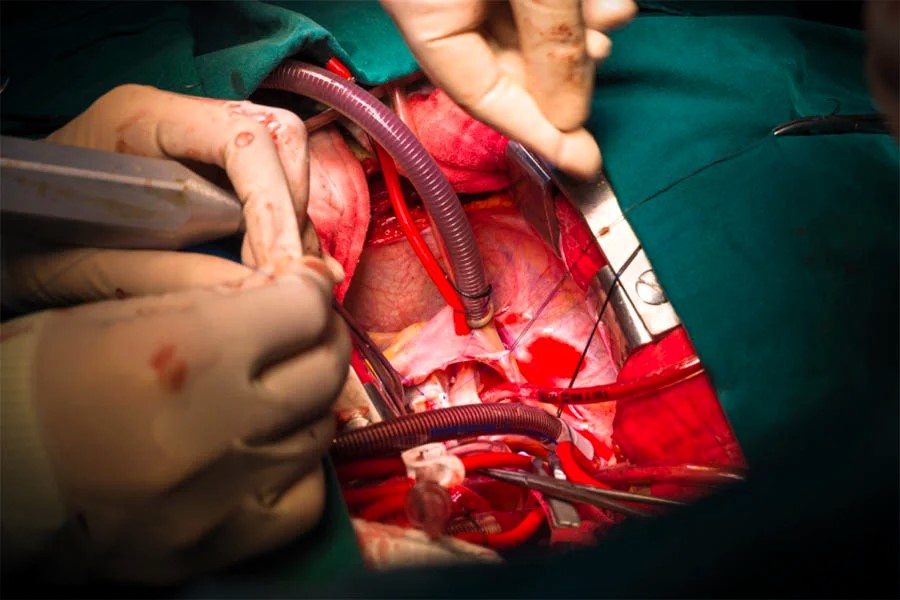 Bharat Vikas Parishad Hospital and Reserch Center